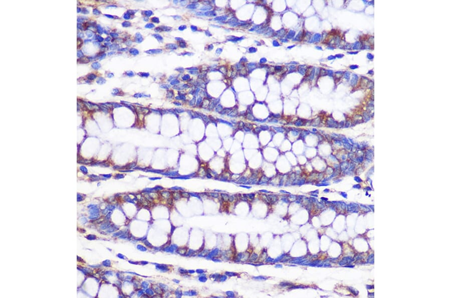 Immunohistochemistry - Anti-NEK9 Antibody (A308715) - Antibodies.com