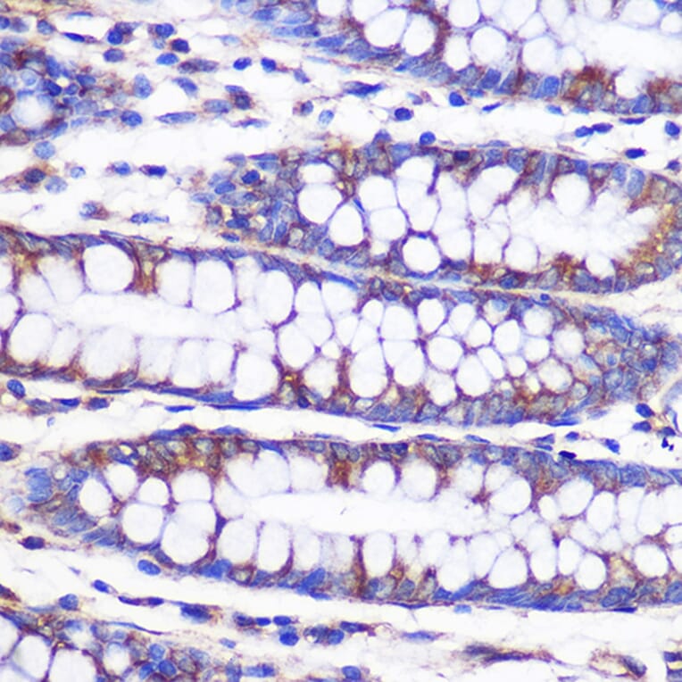 Immunohistochemistry - Anti-NEK9 Antibody (A308715) - Antibodies.com