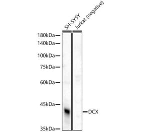 Western Blot - Anti-Doublecortin Antibody (A308716) - Antibodies.com