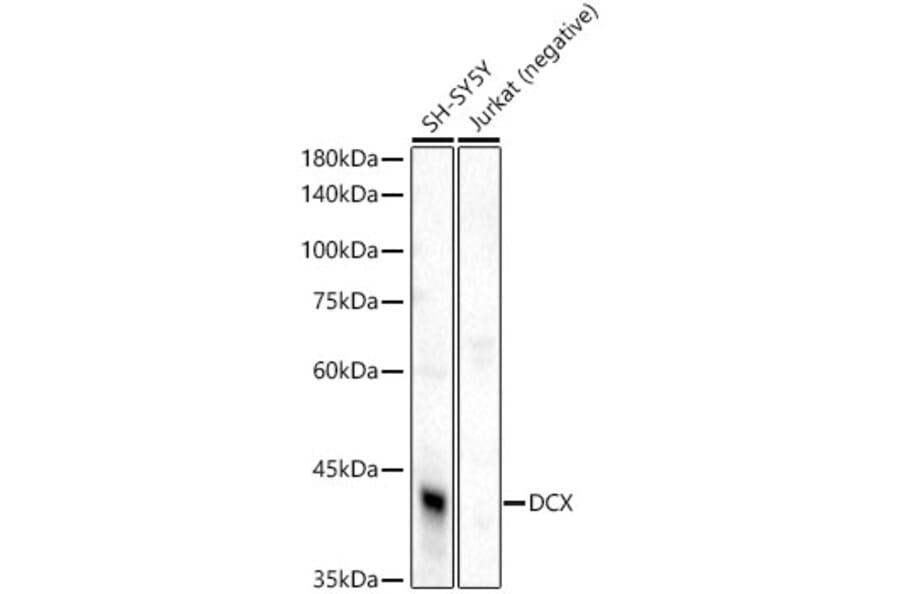 Western Blot - Anti-Doublecortin Antibody (A308716) - Antibodies.com