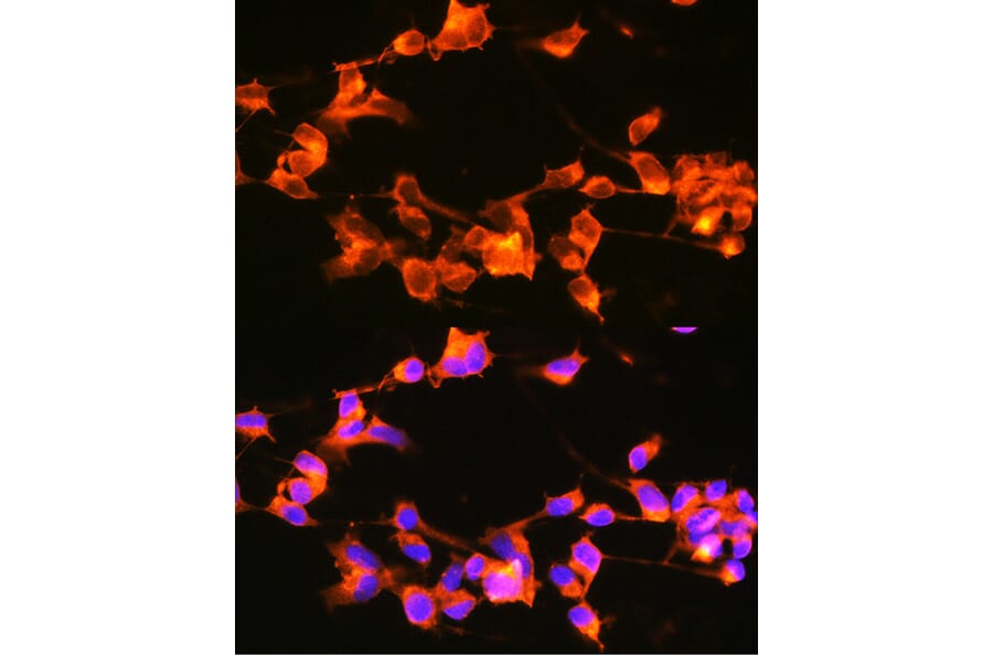 Immunofluorescence - Anti-Doublecortin Antibody (A308716) - Antibodies.com