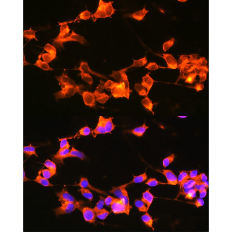 Immunofluorescence - Anti-Doublecortin Antibody (A308716) - Antibodies.com