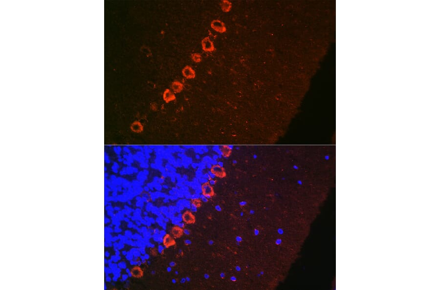 Immunofluorescence - Anti-Doublecortin Antibody (A308716) - Antibodies.com