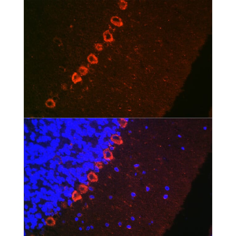 Immunofluorescence - Anti-Doublecortin Antibody (A308716) - Antibodies.com