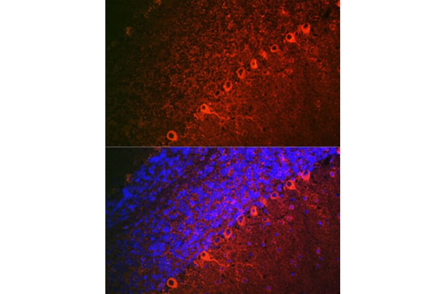 Immunofluorescence - Anti-Doublecortin Antibody (A308716) - Antibodies.com