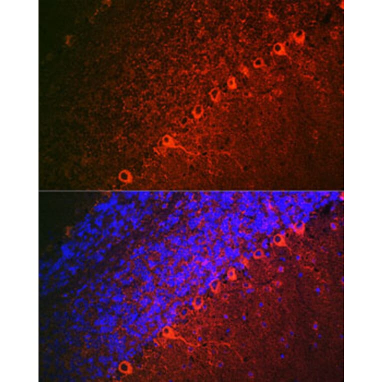 Immunofluorescence - Anti-Doublecortin Antibody (A308716) - Antibodies.com