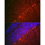 Immunofluorescence - Anti-Doublecortin Antibody (A308716) - Antibodies.com
