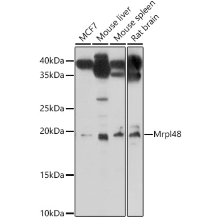 Western Blot - Anti-MRPL48 Antibody (A308720) - Antibodies.com