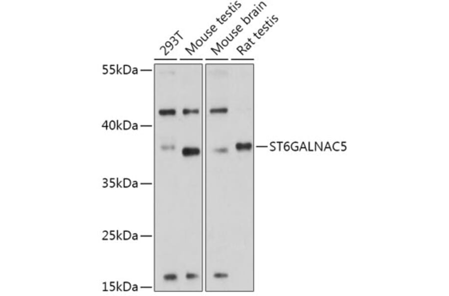 Western Blot - Anti-ST6GALNAC5 Antibody (A308721) - Antibodies.com