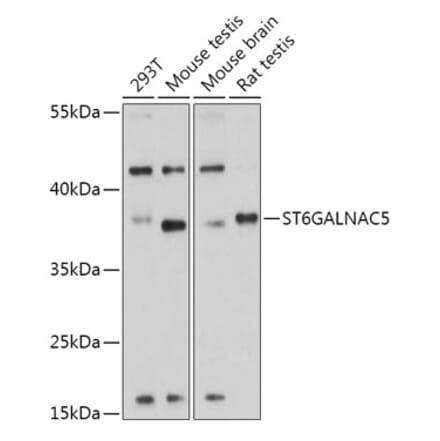 Western Blot - Anti-ST6GALNAC5 Antibody (A308721) - Antibodies.com