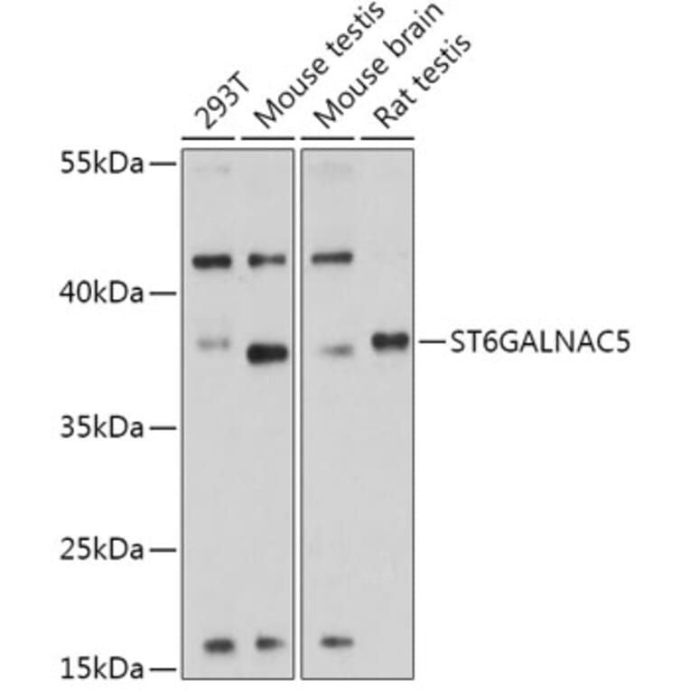Western Blot - Anti-ST6GALNAC5 Antibody (A308721) - Antibodies.com