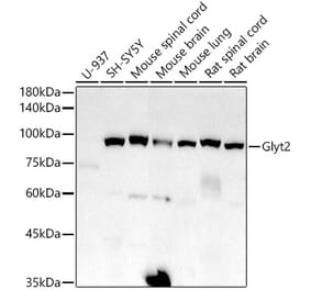 Western Blot - Anti-Glyt2 Antibody [ARC2912] (A308722) - Antibodies.com