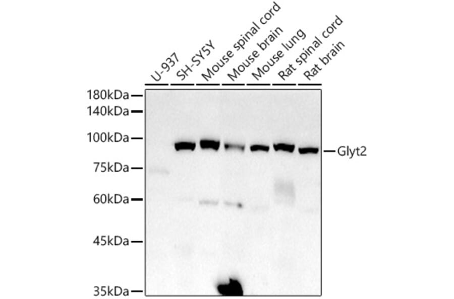 Western Blot - Anti-Glyt2 Antibody [ARC2912] (A308722) - Antibodies.com