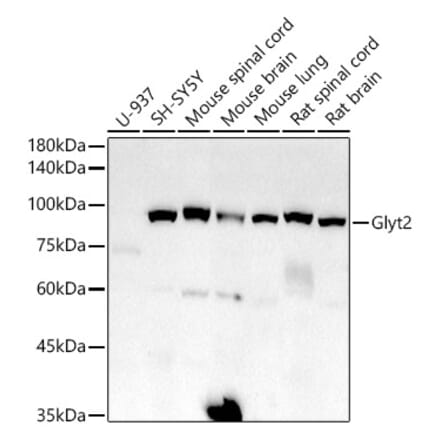 Western Blot - Anti-Glyt2 Antibody [ARC2912] (A308722) - Antibodies.com