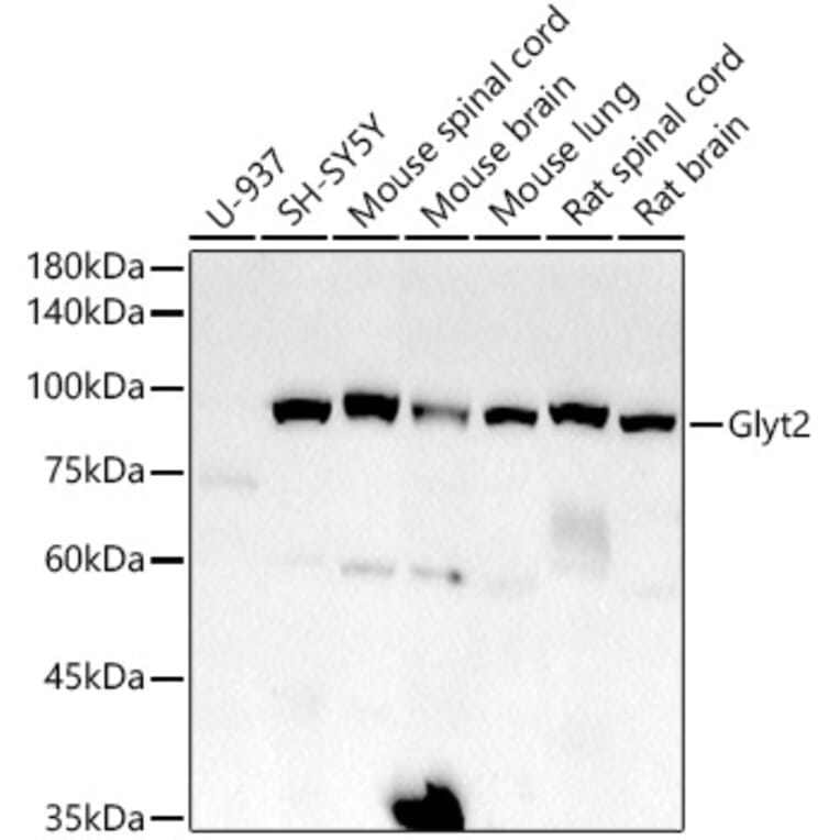 Western Blot - Anti-Glyt2 Antibody [ARC2912] (A308722) - Antibodies.com