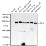 Western Blot - Anti-Glyt2 Antibody [ARC2912] (A308722) - Antibodies.com