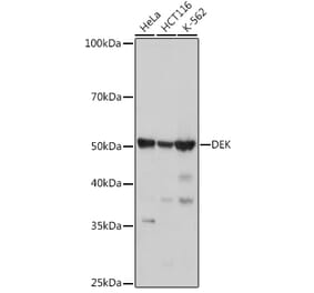 Western Blot - Anti-DEK Antibody [ARC1825] (A308723) - Antibodies.com