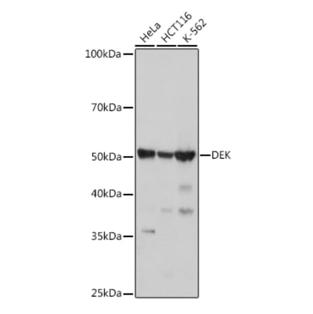 Western Blot - Anti-DEK Antibody [ARC1825] (A308723) - Antibodies.com