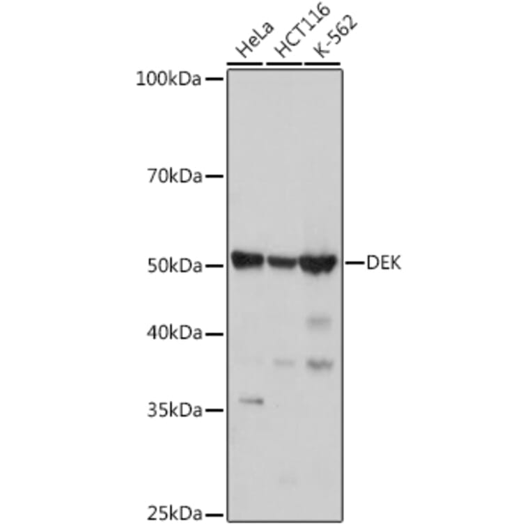 Western Blot - Anti-DEK Antibody [ARC1825] (A308723) - Antibodies.com