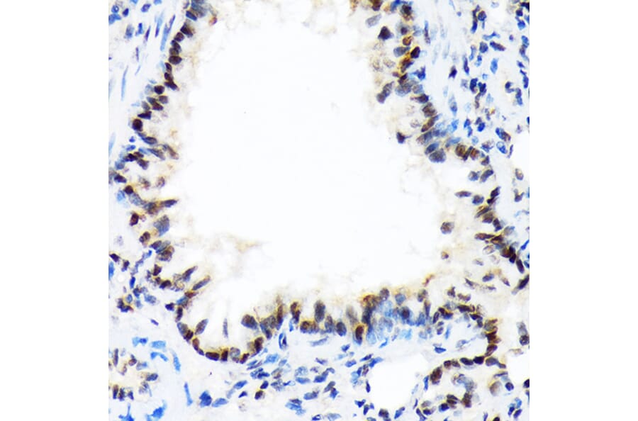 Immunohistochemistry - Anti-DEK Antibody [ARC1825] (A308723) - Antibodies.com