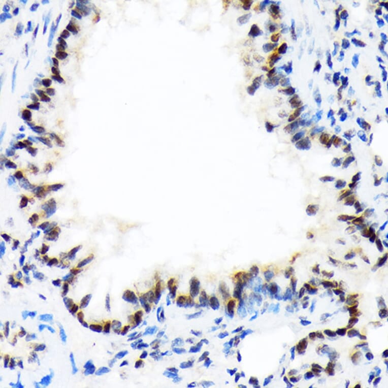 Immunohistochemistry - Anti-DEK Antibody [ARC1825] (A308723) - Antibodies.com