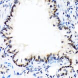 Immunohistochemistry - Anti-DEK Antibody [ARC1825] (A308723) - Antibodies.com