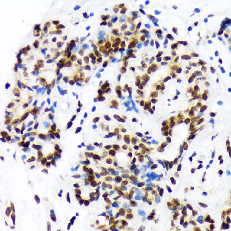 Immunohistochemistry - Anti-DEK Antibody [ARC1825] (A308723) - Antibodies.com