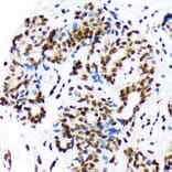 Immunohistochemistry - Anti-DEK Antibody [ARC1825] (A308723) - Antibodies.com