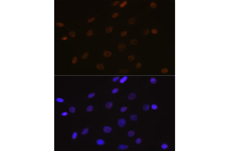 Immunofluorescence - Anti-DEK Antibody [ARC1825] (A308723) - Antibodies.com
