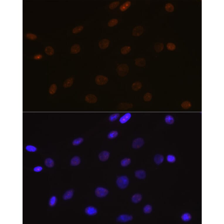 Immunofluorescence - Anti-DEK Antibody [ARC1825] (A308723) - Antibodies.com