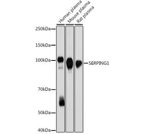 Western Blot - Anti-C1 inhibitor Antibody [ARC2427] (A308724) - Antibodies.com