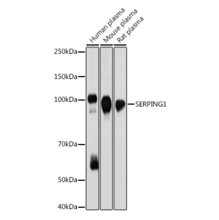 Western Blot - Anti-C1 inhibitor Antibody [ARC2427] (A308724) - Antibodies.com