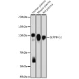 Western Blot - Anti-C1 inhibitor Antibody [ARC2427] (A308724) - Antibodies.com