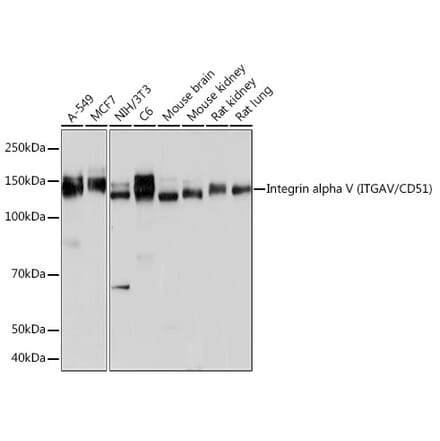 Western Blot - Anti-Integrin alpha V Antibody [ARC50621] (A308725) - Antibodies.com