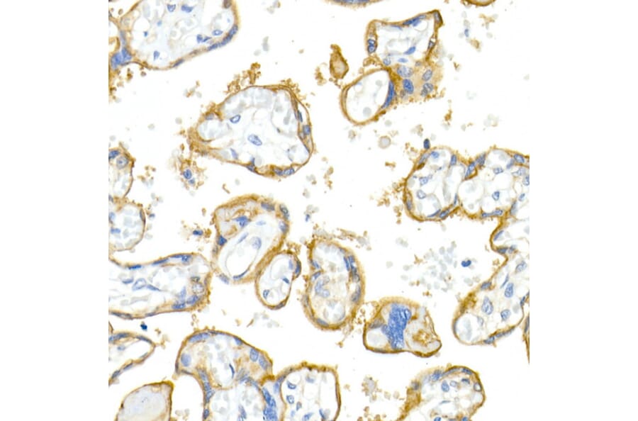 Immunohistochemistry - Anti-Integrin alpha V Antibody [ARC50621] (A308725) - Antibodies.com