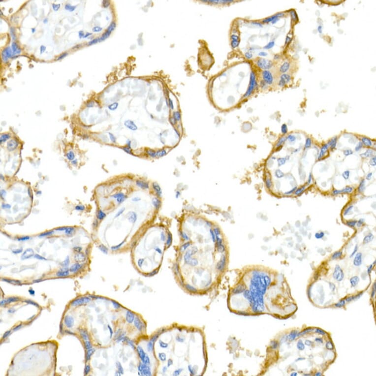 Immunohistochemistry - Anti-Integrin alpha V Antibody [ARC50621] (A308725) - Antibodies.com