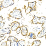 Immunohistochemistry - Anti-Integrin alpha V Antibody [ARC50621] (A308725) - Antibodies.com