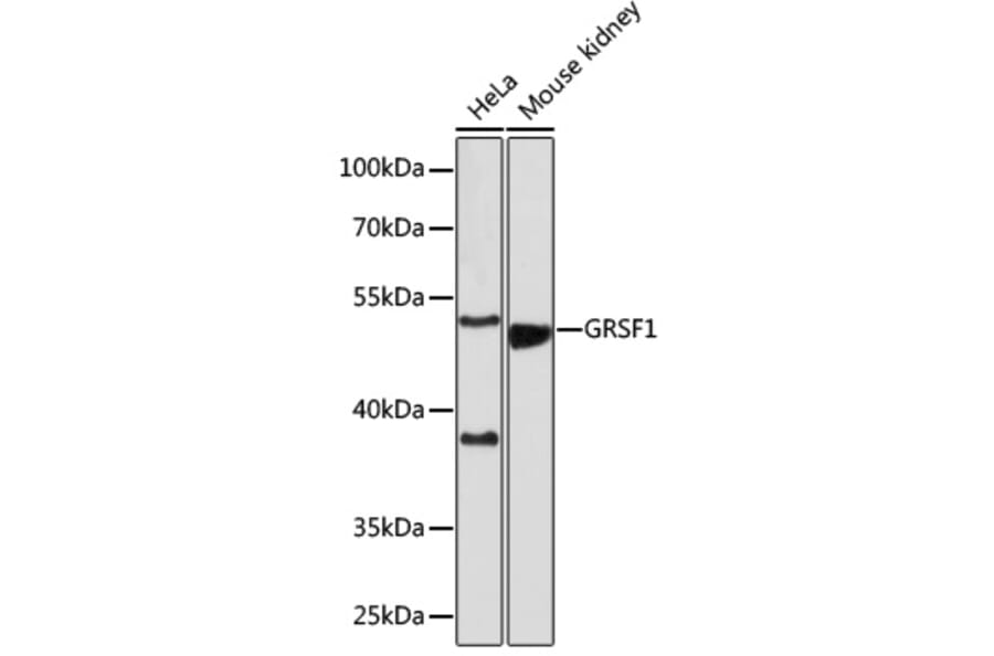 Western Blot - Anti-GRSF1 Antibody (A308726) - Antibodies.com