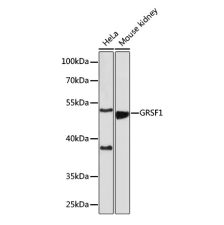 Western Blot - Anti-GRSF1 Antibody (A308726) - Antibodies.com