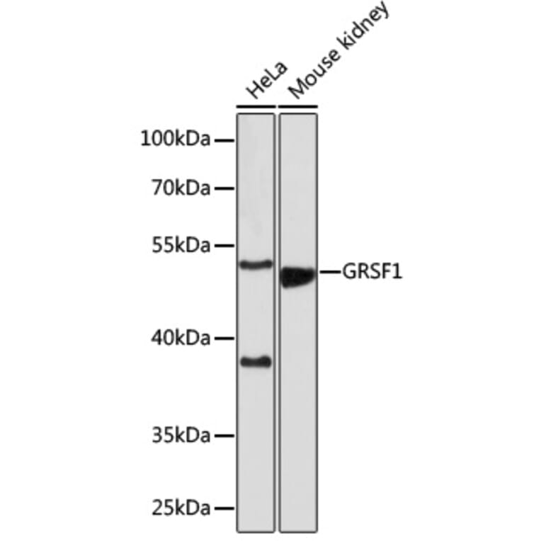 Western Blot - Anti-GRSF1 Antibody (A308726) - Antibodies.com