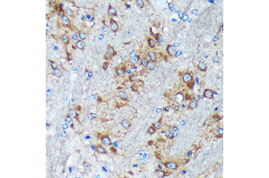 Immunohistochemistry - Anti-GRSF1 Antibody (A308726) - Antibodies.com
