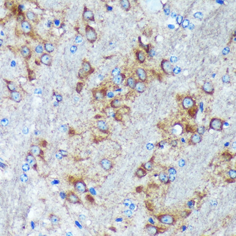 Immunohistochemistry - Anti-GRSF1 Antibody (A308726) - Antibodies.com