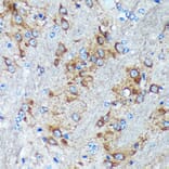 Immunohistochemistry - Anti-GRSF1 Antibody (A308726) - Antibodies.com