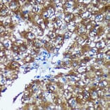 Immunohistochemistry - Anti-GRSF1 Antibody (A308726) - Antibodies.com