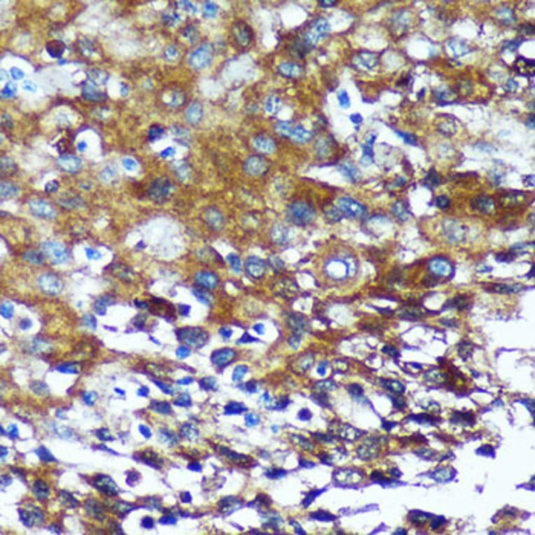 Immunohistochemistry - Anti-GRSF1 Antibody (A308726) - Antibodies.com