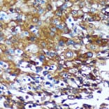 Immunohistochemistry - Anti-GRSF1 Antibody (A308726) - Antibodies.com