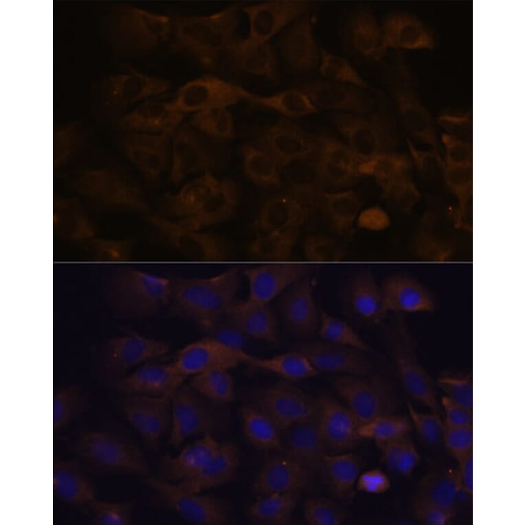 Immunofluorescence - Anti-GRSF1 Antibody (A308726) - Antibodies.com