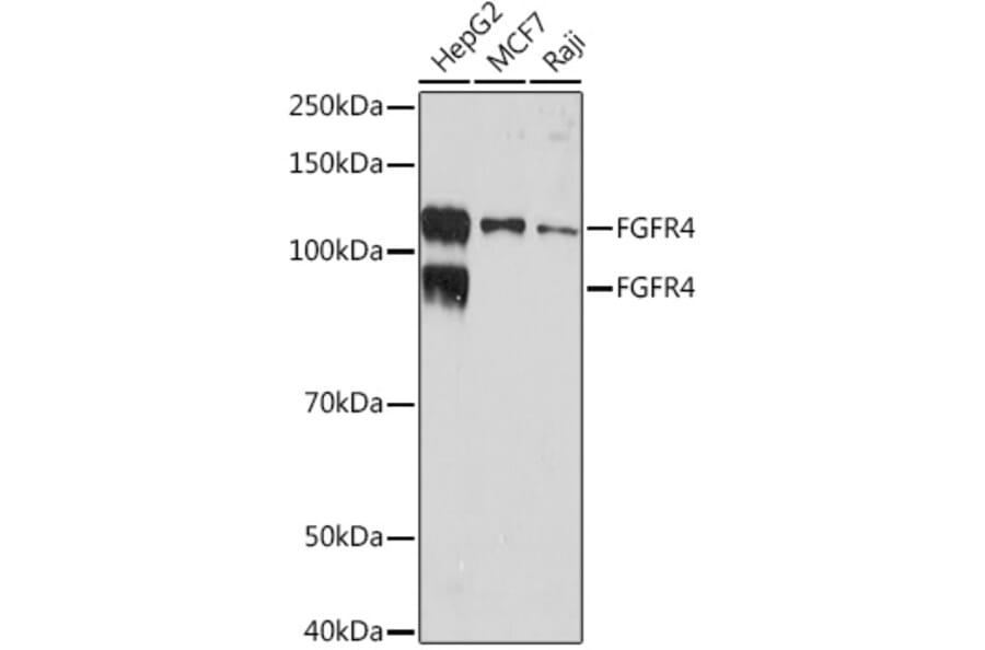 Western Blot - Anti-FGFR4 Antibody [ARC1474] (A308727) - Antibodies.com