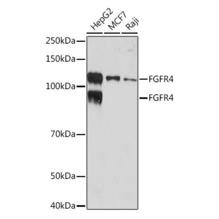 Western Blot - Anti-FGFR4 Antibody [ARC1474] (A308727) - Antibodies.com