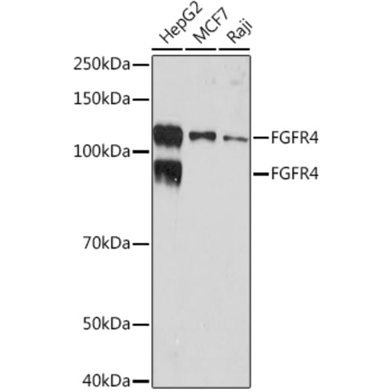 Western Blot - Anti-FGFR4 Antibody [ARC1474] (A308727) - Antibodies.com